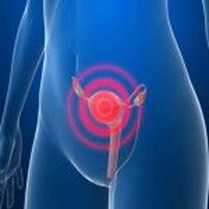 SESA se suma a la conmemoración del Día Nacional contra el Cáncer Cervicouterino